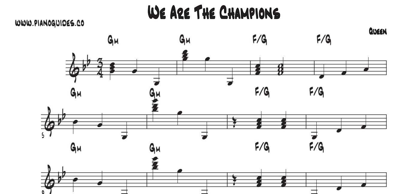 Título y primeras líneas de la guía de We Are The Champions